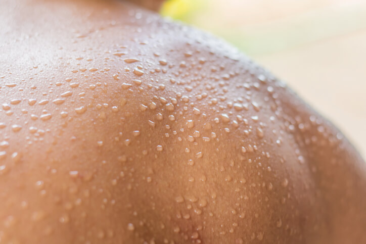 Close up of sweaty skin